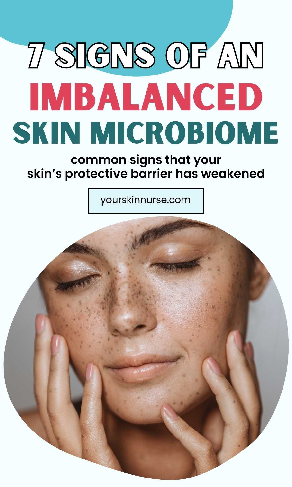 7 signs of an imbalanced skin microbiome