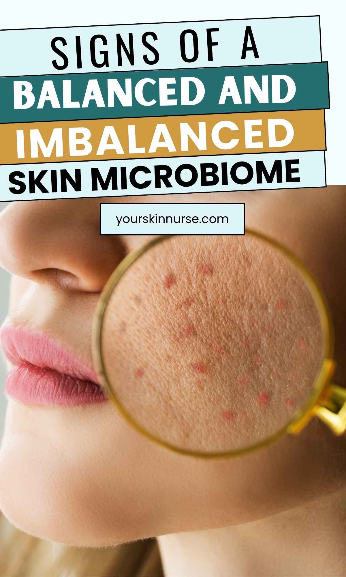 signs of a balanced and imbalanced skin microbiome