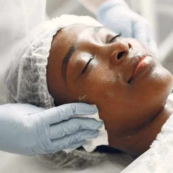 non-laser treatment services before and after- Xubian wellness and acne clinic corrective skincare treatments for black women